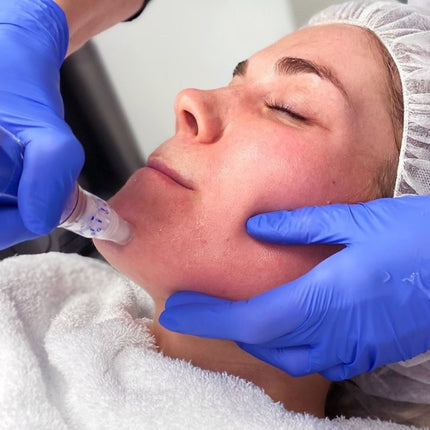 Collection image for: SKINPEN MICRONEEDLING