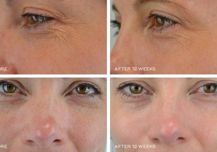 Crystal Retinal 10 - Medik8